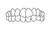 Generally Straight Teeth