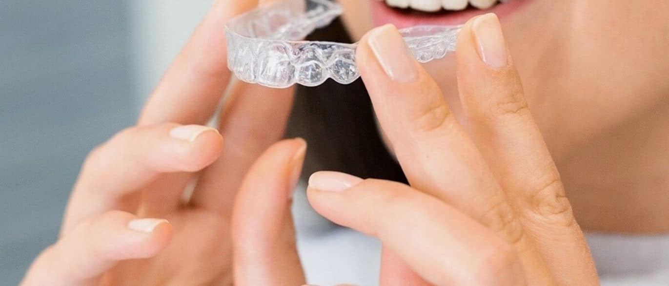 the truth behind common Invisalign myths