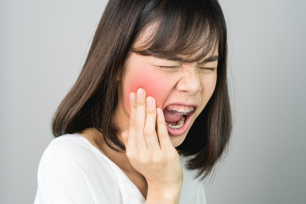 Dental Emergency Culver City